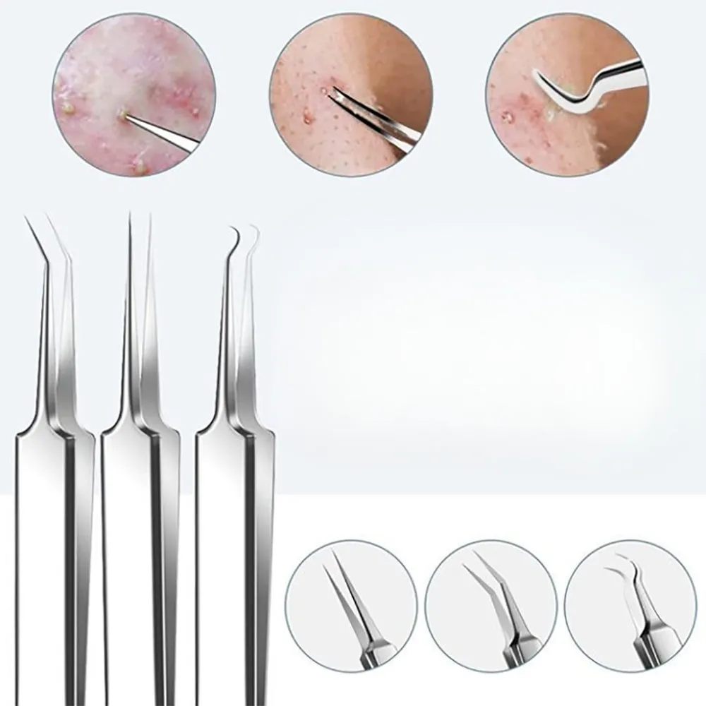 15Pcs  Stainless Steel Blackhead Remover Pimple Popper Tools Kit with Metal Case